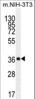 ABHD17C / FAM108C1 Antibody (aa92-121)