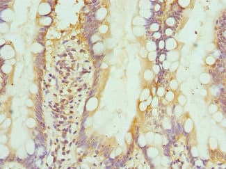 INTS10 Antibody