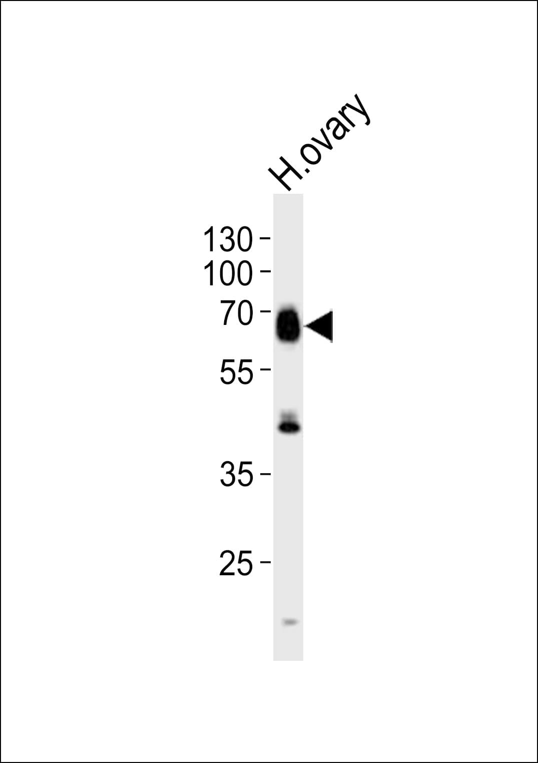 RYK Antibody (aa160-190)
