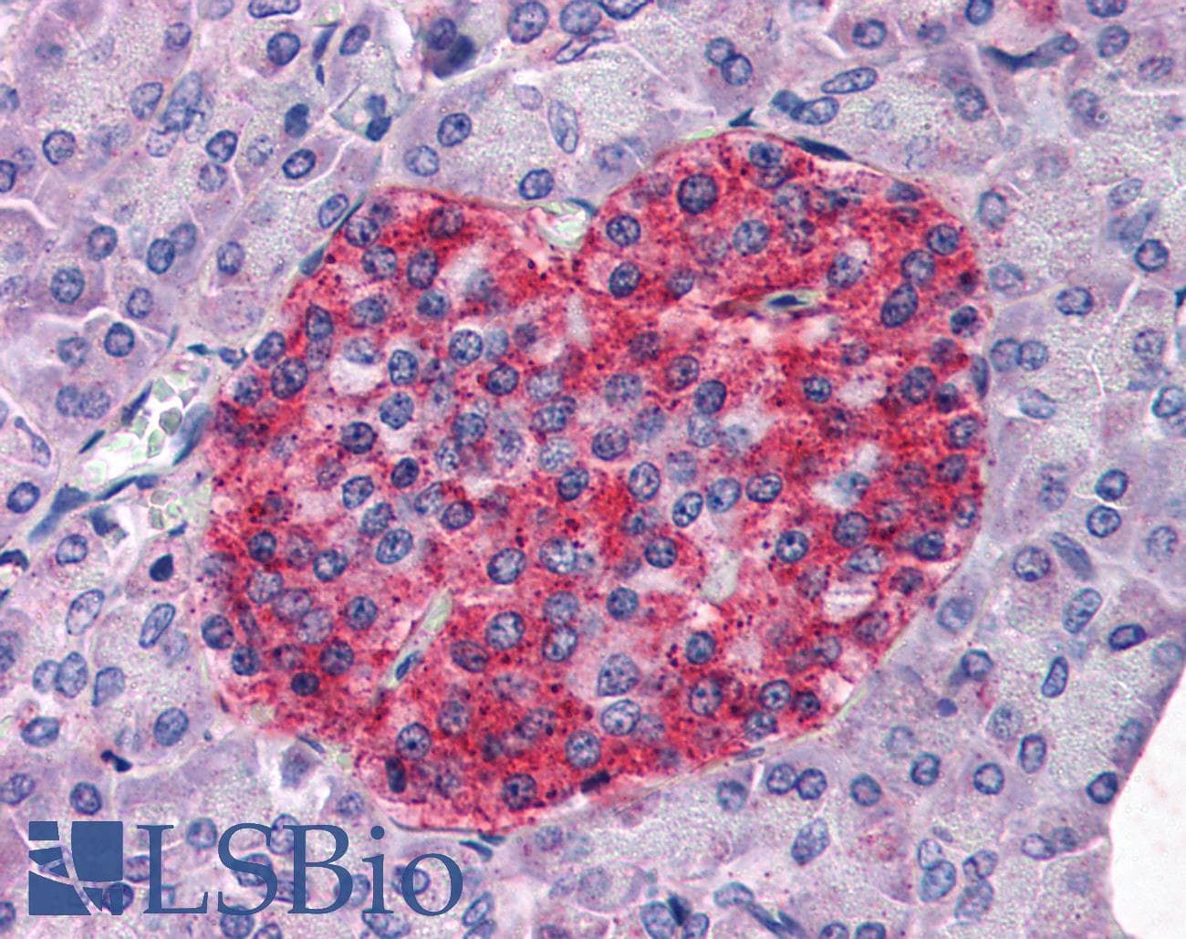 IHC-plus™ Polyclonal Goat anti-Human ANXA10 / Annexin A10 Antibody (aa2-16, IHC)