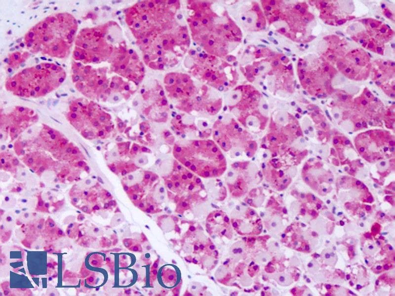 IHC-plus™ Polyclonal Rabbit anti-Human PRKD2 / PKD2 Antibody (Internal, IHC)