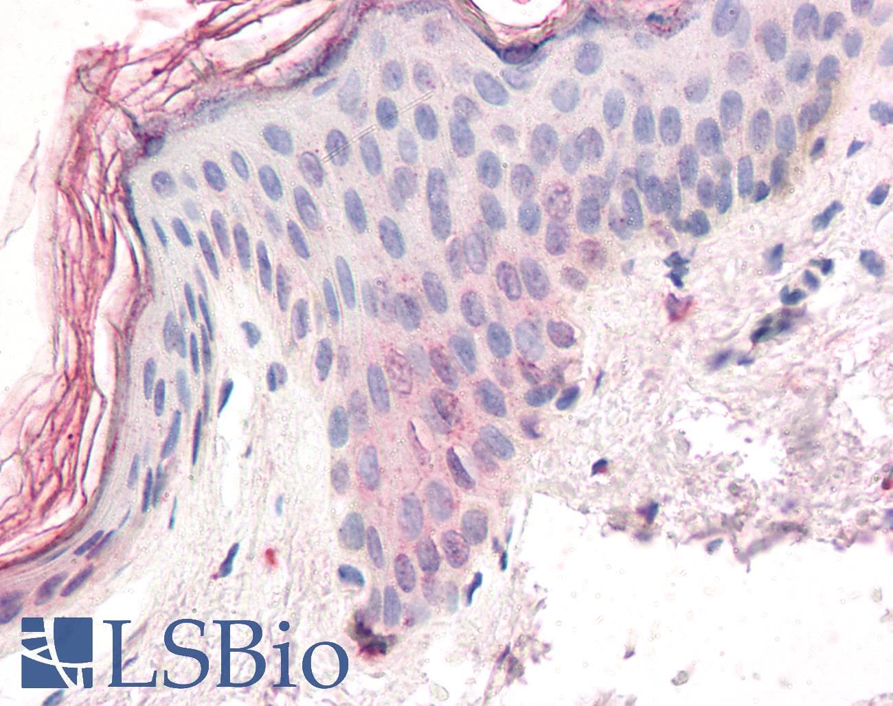 IHC-plus™ ZIC5 Antibody (aa651-663)