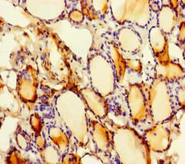 SLITRK6 Antibody