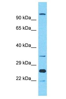Polyclonal Rabbit anti-Human OR10A2 Antibody (aa230-279, WB)