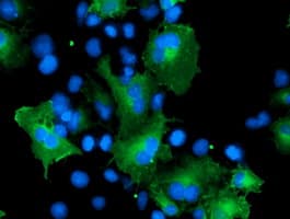 CCM2 / Malcavernin Antibody (clone OTI5H4)