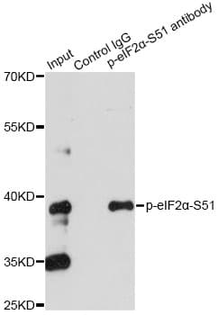 EIF2S1 Antibody (phospho-Ser51)