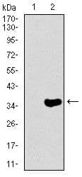 NEFH / NF-H Antibody (Amino Acid: 968-1020, clone 8H10)