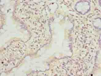 Polyclonal Rabbit anti-Human TMEM243 Antibody (IHC)