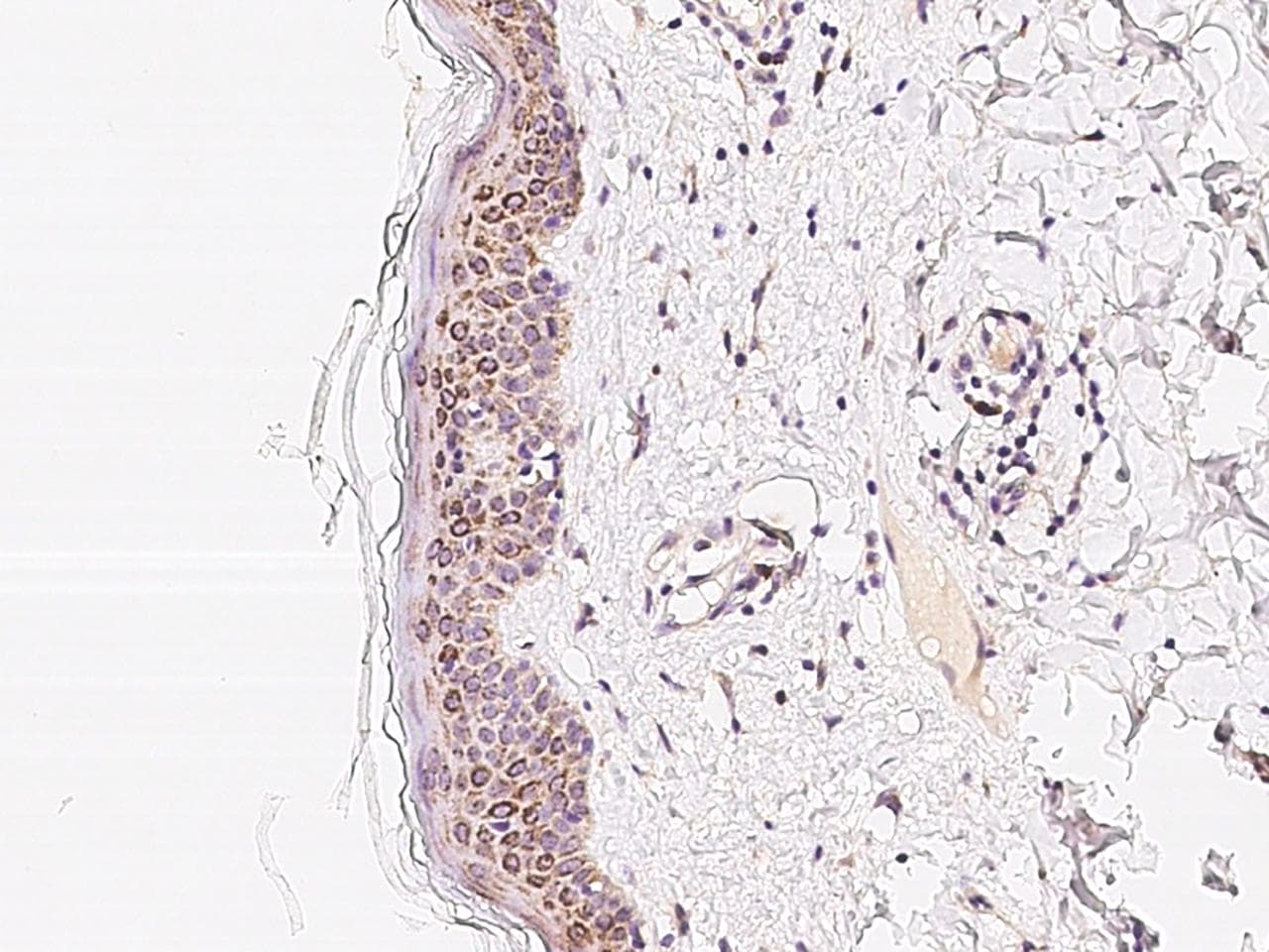 PLA2G4F Antibody