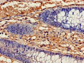 IDH1 / IDH Antibody