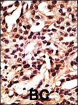 Polyclonal Rabbit anti-Human APG12 / ATG12 Antibody (aa1-30, IHC, IF, WB)