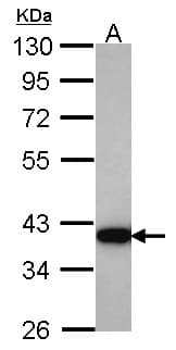 AKR1C4 / Chlordecone Reductase Antibody (aa1-217)