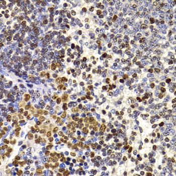 Polyclonal Rabbit anti-Human HIRIP3 Antibody (IHC, IF, WB)