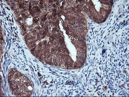 HDHD1 Antibody (clone OTI3E11)