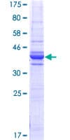 Human GC1qR / C1QBP Protein (Recombinant GST, N-terminus)