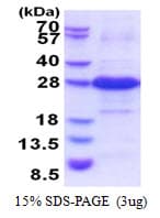Human IYD Protein (Recombinant His)