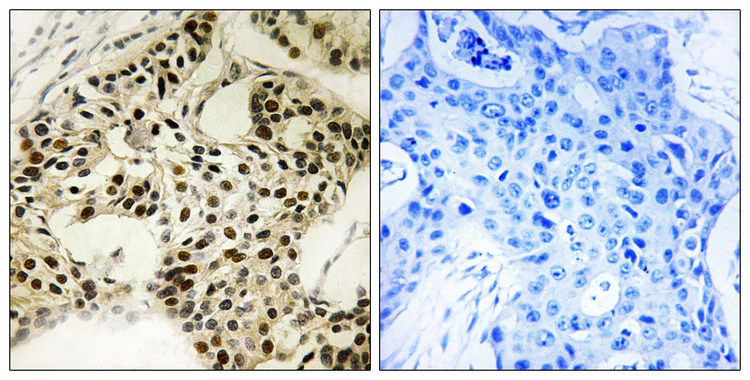 STK11 / LKB1 Antibody (phospho-Ser334)