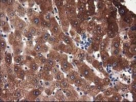 ADSL / Adenylosuccinate Lyase Antibody (clone OTI2D10)