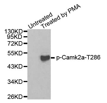 CAMK2A / CaMKII Alpha Antibody (phospho-Thr286)