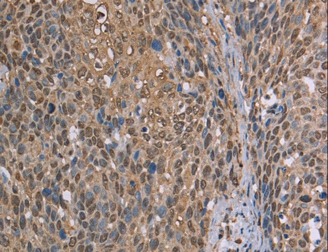 CAB39 / MO25 Antibody