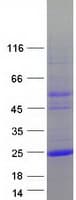 Human LAGE3 Protein (Recombinant Myc-DDK (Flag))