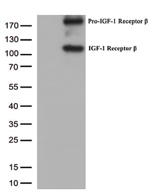 IGF1R / IGF1 Receptor Antibody (aa741-935, clone OTI11E4)