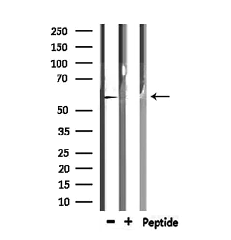 TRIM21 / RO52 Antibody
