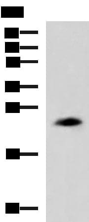 Polyclonal Rabbit anti-Human CLTB Antibody (IHC, WB)