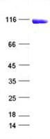 Human PARP1 Protein (Recombinant DDK,C-terminus)