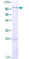 Human ACSM5 / MACS3 Protein (Recombinant GST)