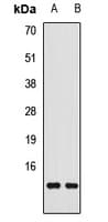 IHC-plus™ TTR / Transthyretin Antibody