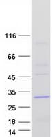 Human ABHD14B Protein (Recombinant Myc-DDK (Flag))