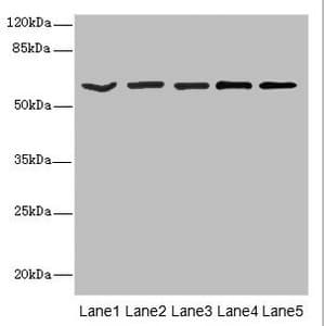 Polyclonal Rabbit anti-Human ACCN3 / ASIC3 Antibody (IHC, WB)