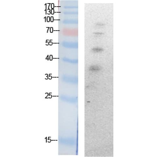 Ubiquitin Antibody (around the acetylation site of K27.)