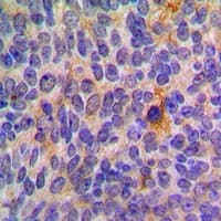 CCL17 / TARC Antibody