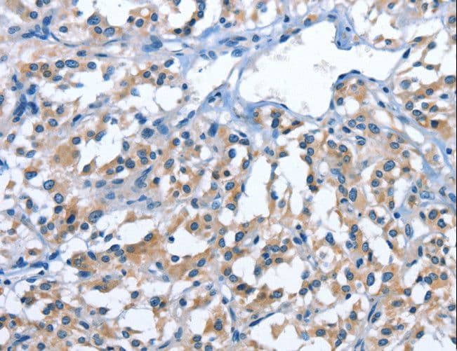 PAK6 Antibody