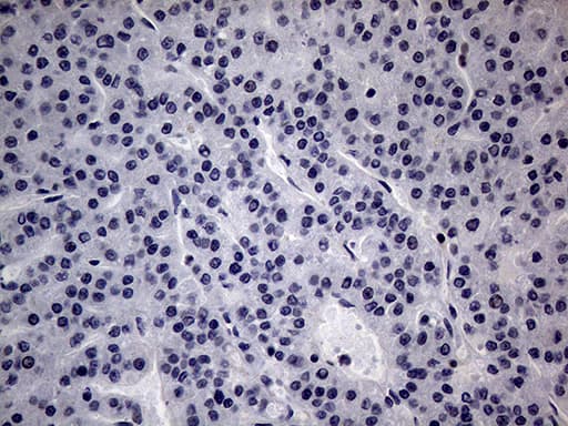CFI / Complement Factor I Antibody (aa340-583, clone OTI7C8)