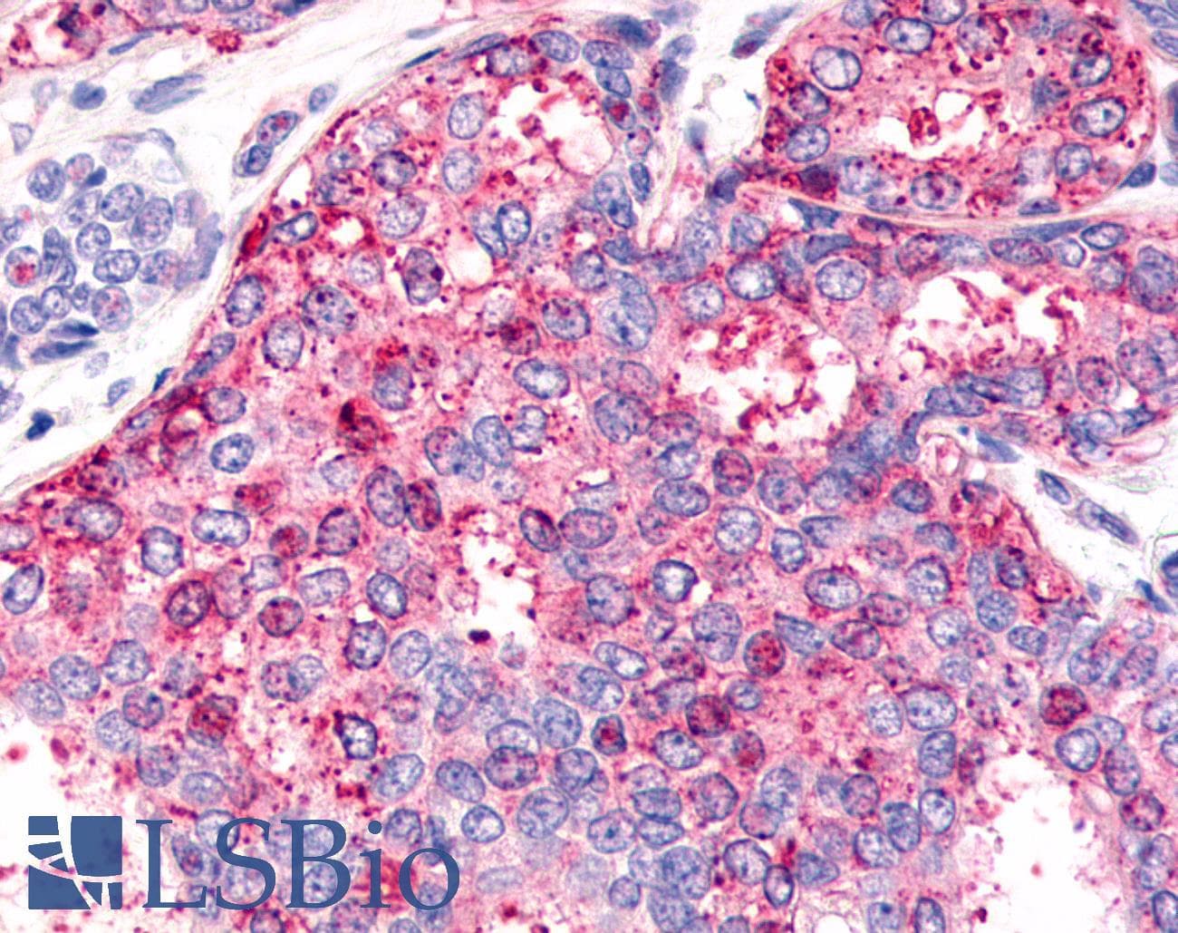 PathPlus™ HNF4G / HNF4 Gamma Antibody (Internal)