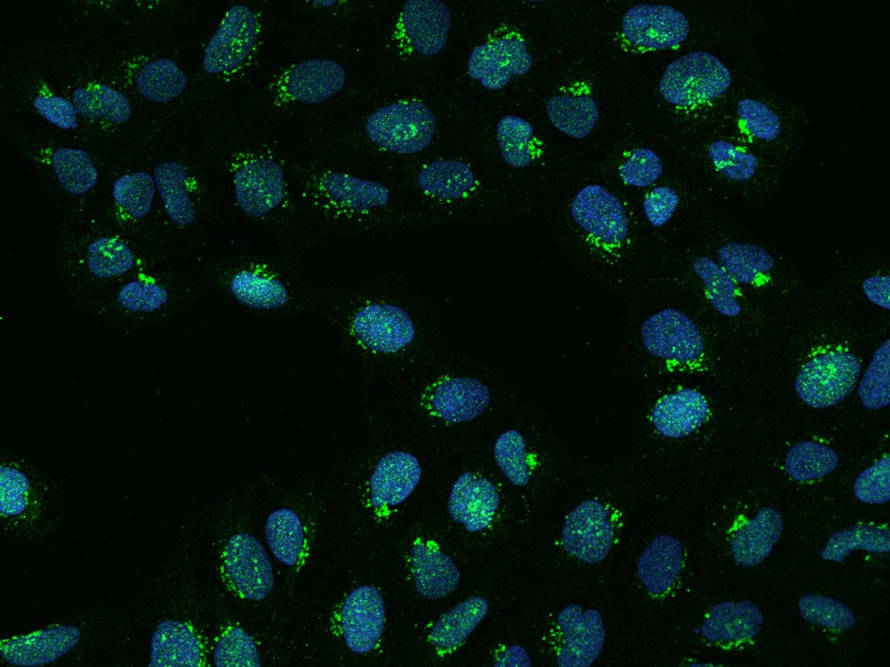 PLEKHA8 Antibody