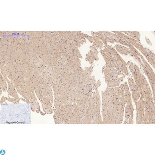 Polyclonal Rabbit anti-Human APP / Beta Amyloid Precursor Antibody (WB)