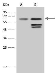 SOAT1 Antibody