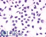 PathPlus™ Polyclonal Rabbit anti-Human CNR1 / CB1 Antibody (Cytoplasmic Domain, IHC)