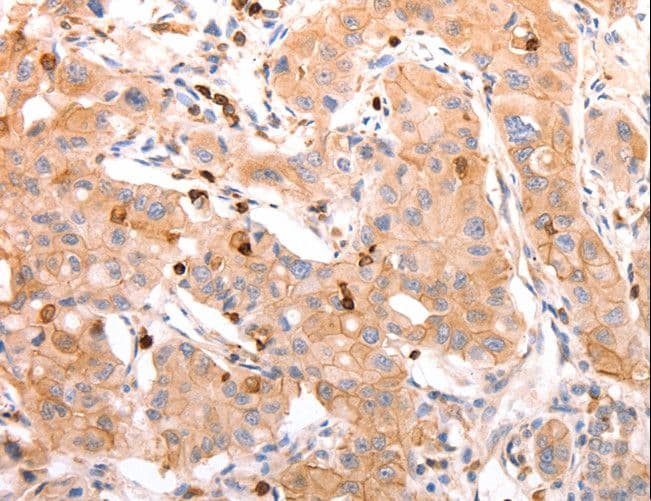 CELSR2 Antibody