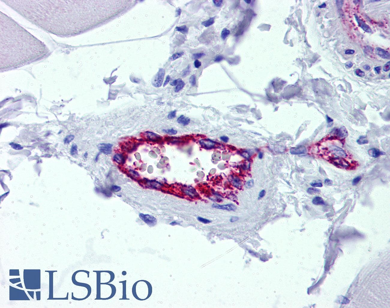 IHC-plus™ AAAS / Adracalin Antibody (clone 5A1)