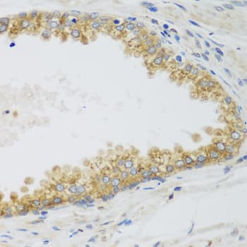 SIRT3 / Sirtuin 3 Antibody