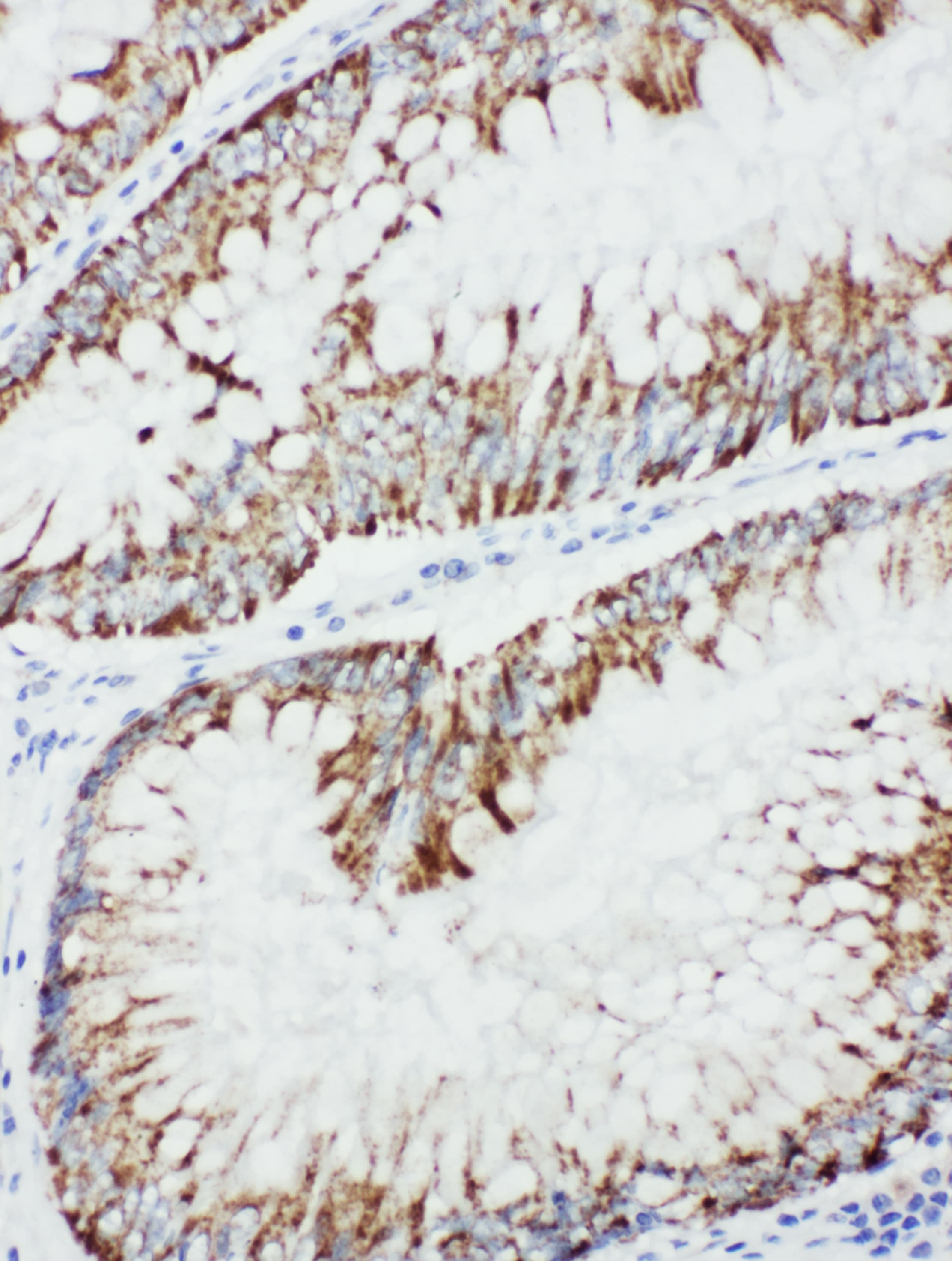 Polyclonal Rabbit anti-Human MAP3K1 / MEKK1 Antibody (aa1418-1432, IHC, WB)