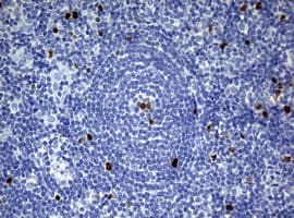 Monoclonal Mouse anti-Human MKI67 / Ki67 Antibody (clone OTI5D7, IHC)