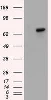 Monoclonal Mouse anti-Human BTK Antibody (clone OTI10E10, IHC, IF, WB)