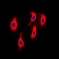 Polyclonal Rabbit anti-Human ACTN2 Antibody (N-Terminus, IHC, IF, WB)