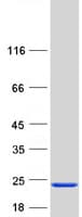 Human NCALD / Neurocalcin Delta Protein (Recombinant Myc-DDK (Flag))